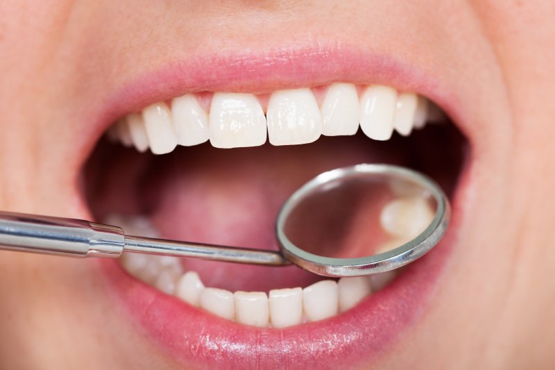 Mouth examined with dental mirror